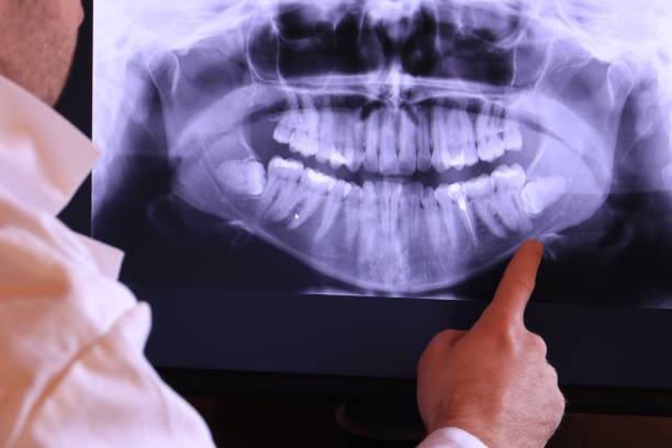 Best Emergency Treatment for Toothache in Oswego, IL