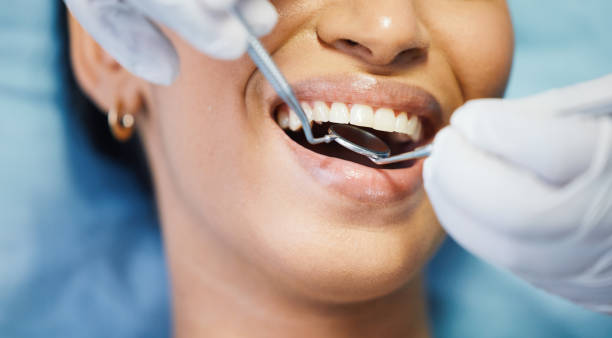 Best Emergency Root Canal Treatment in Oswego, IL